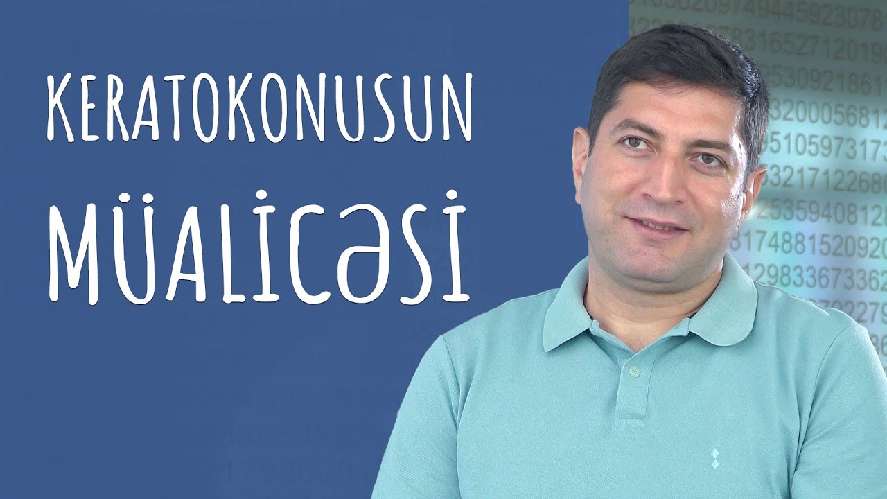 Keratokonusun müalicəsi #RafadarXalilov #Keratokonus