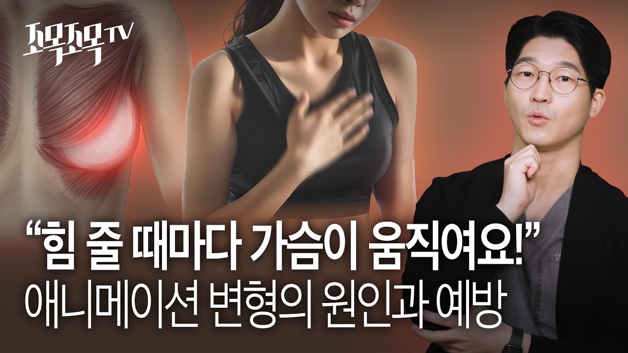 힘 줄 때마다 가슴이 움직여요! : 애니메이션 변형(Animation Deformity)의 원인과 예방