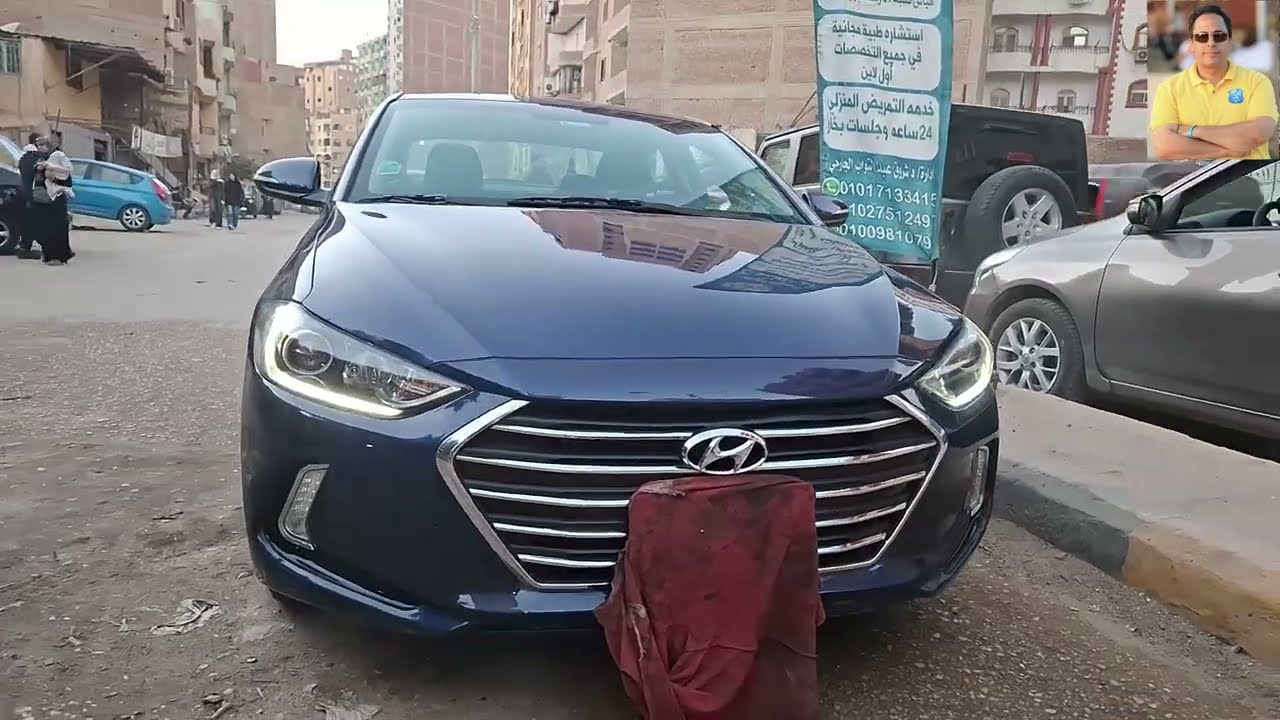 تجديد سياره بالكامل خارجيا وداخليا وتسليمها اقرب لوضع الفابريقه