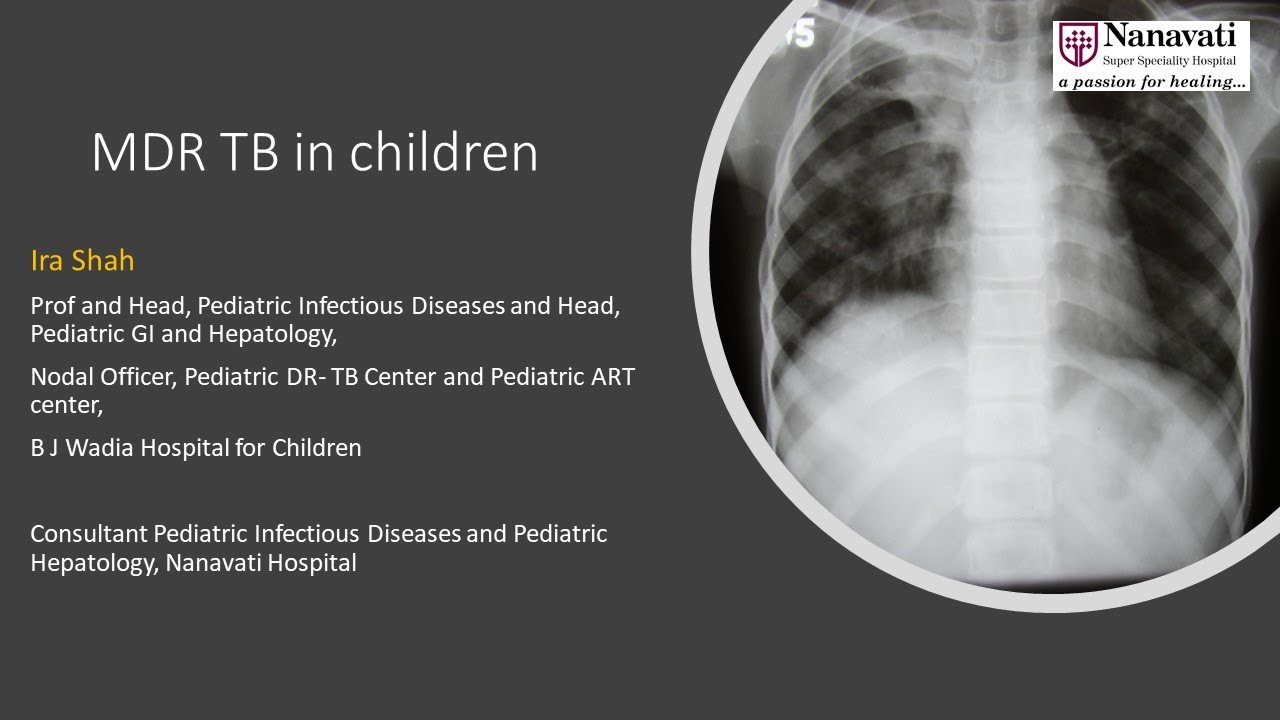 MDR TB in Children | Dr Ira Shah