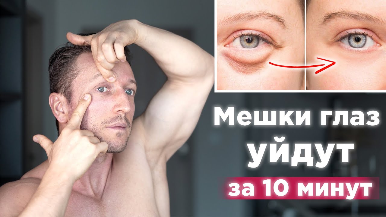 Как быстро убрать МЕШКИ И ОТЁКИ ПОД ГЛАЗАМИ. Упражнения от мешков под глазами