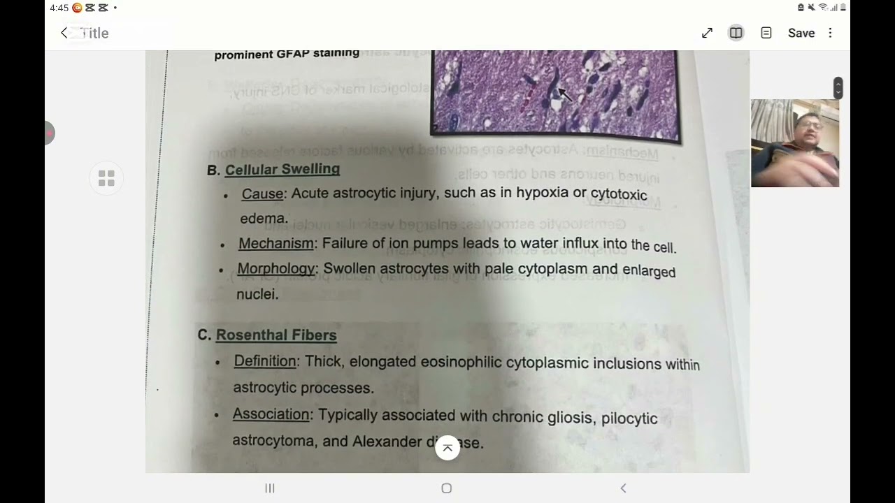 Crash pathology   cns 2 (Mcq and written )