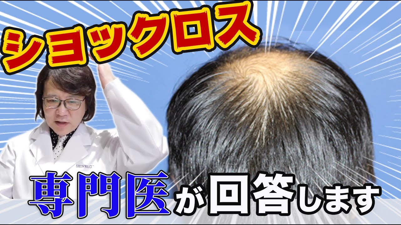【自毛植毛】ショックロスについて専門医が回答いたします。