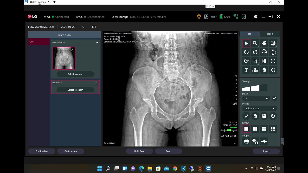 LG Chiropractic DR Systems Software Demonstration