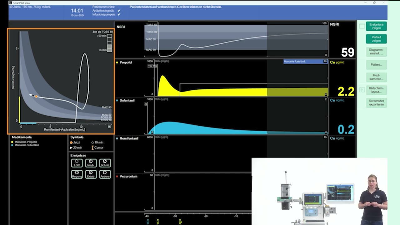 SmartPilot View Training – Time-to-Toss
