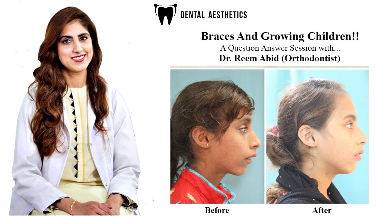 Children's Dental and Facial Symmetry | Braces | Growth Modification | Jaw Disparity