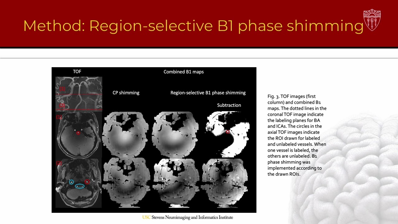 ISMRM 2022 - Improve super-selective ASL with pTx