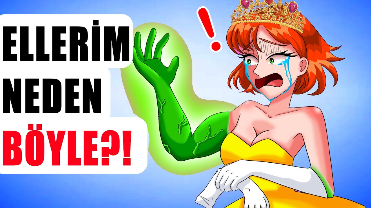 Neden Ellerim Yeşil ? Tuhaf Hikayem / Hikayem Bitmedi
