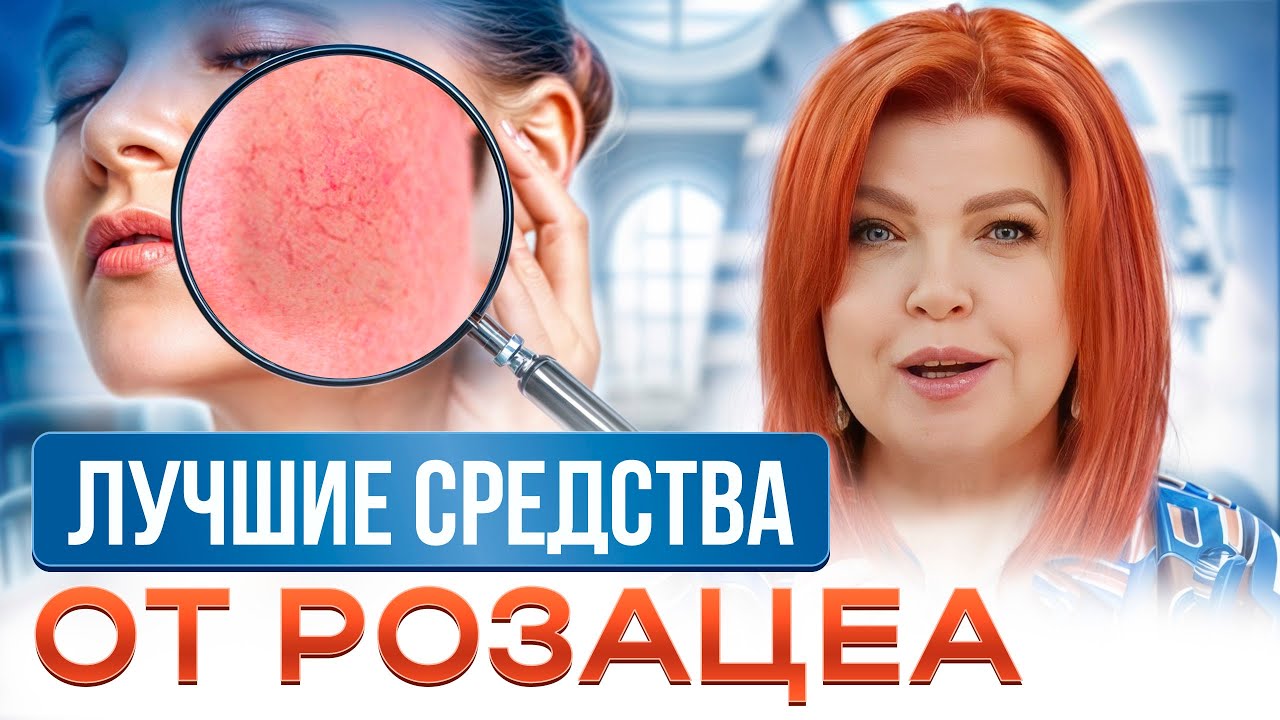 ЗАБУДЬТЕ про красные щеки! / Как вовремя ПРЕДОТВРАТИТЬ розацеа на коже лица?