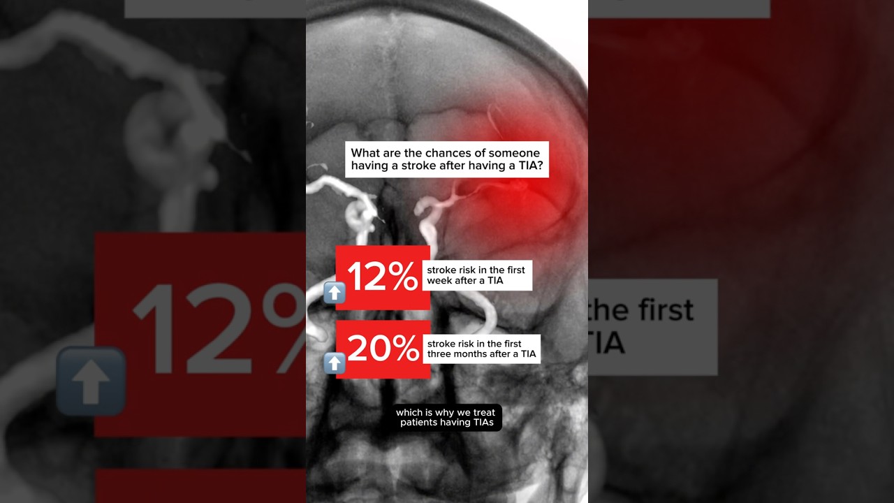 What is a TIA (Transient Ischemic Stroke)?