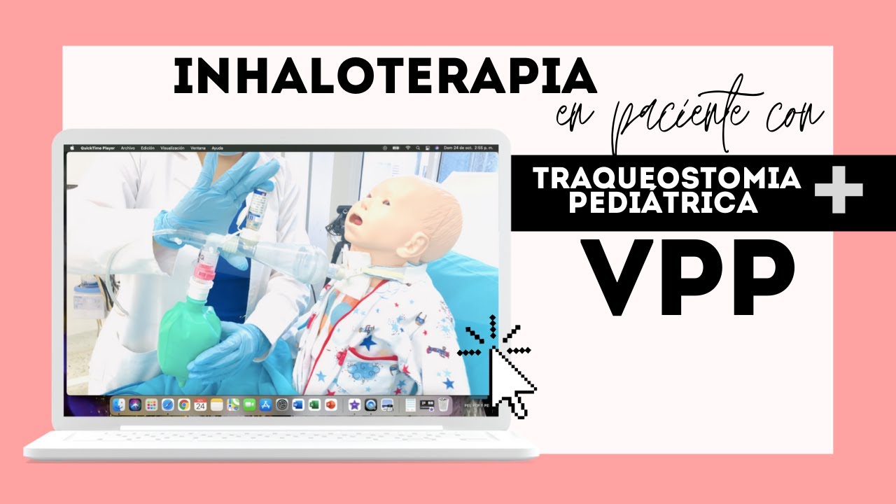 Inhaloterapia + Ventilación con Presión Positiva en Traqueostomia Pediátrica