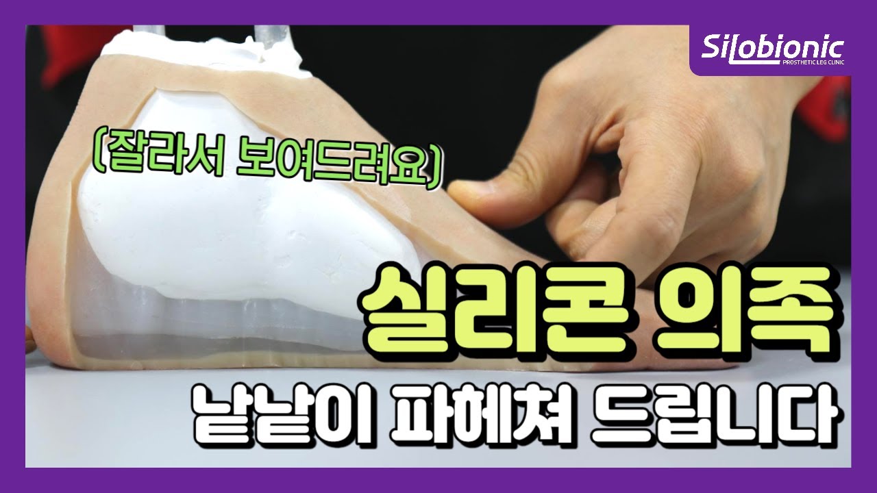 [4k 풀영상] 지금까지 본 적 없을걸요? 의족 단면 공개!!😱 | 실리콘 의족 제작 전문 실로바이오닉