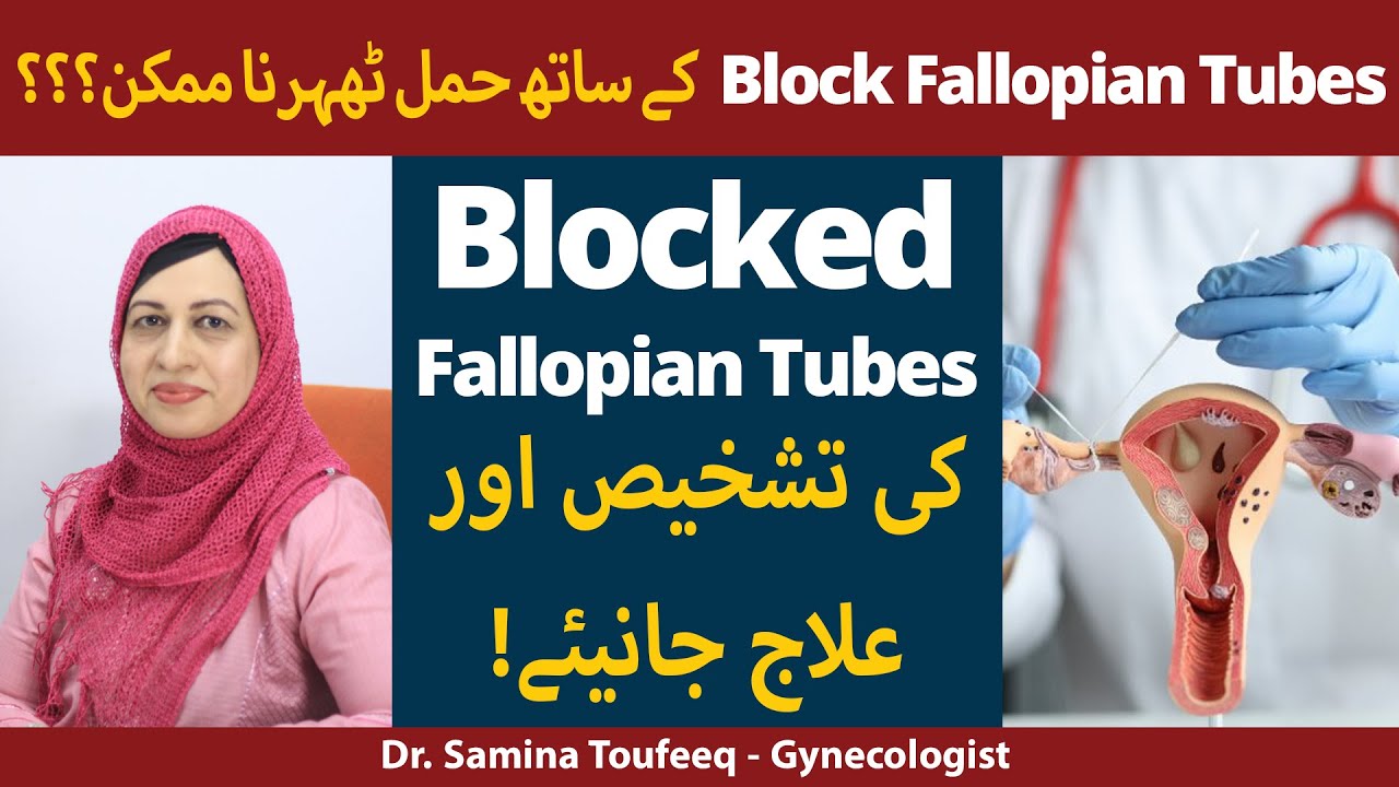 Blocked Fallopian Tubes | Treatment of Block Tubes | How to Get Pregnant with Blocked Tubes in Urdu