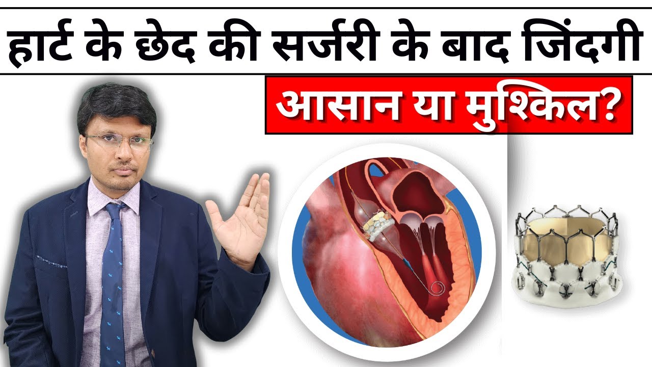 LIFE AFTER DEVICE CLOSURE congenital heart disease
