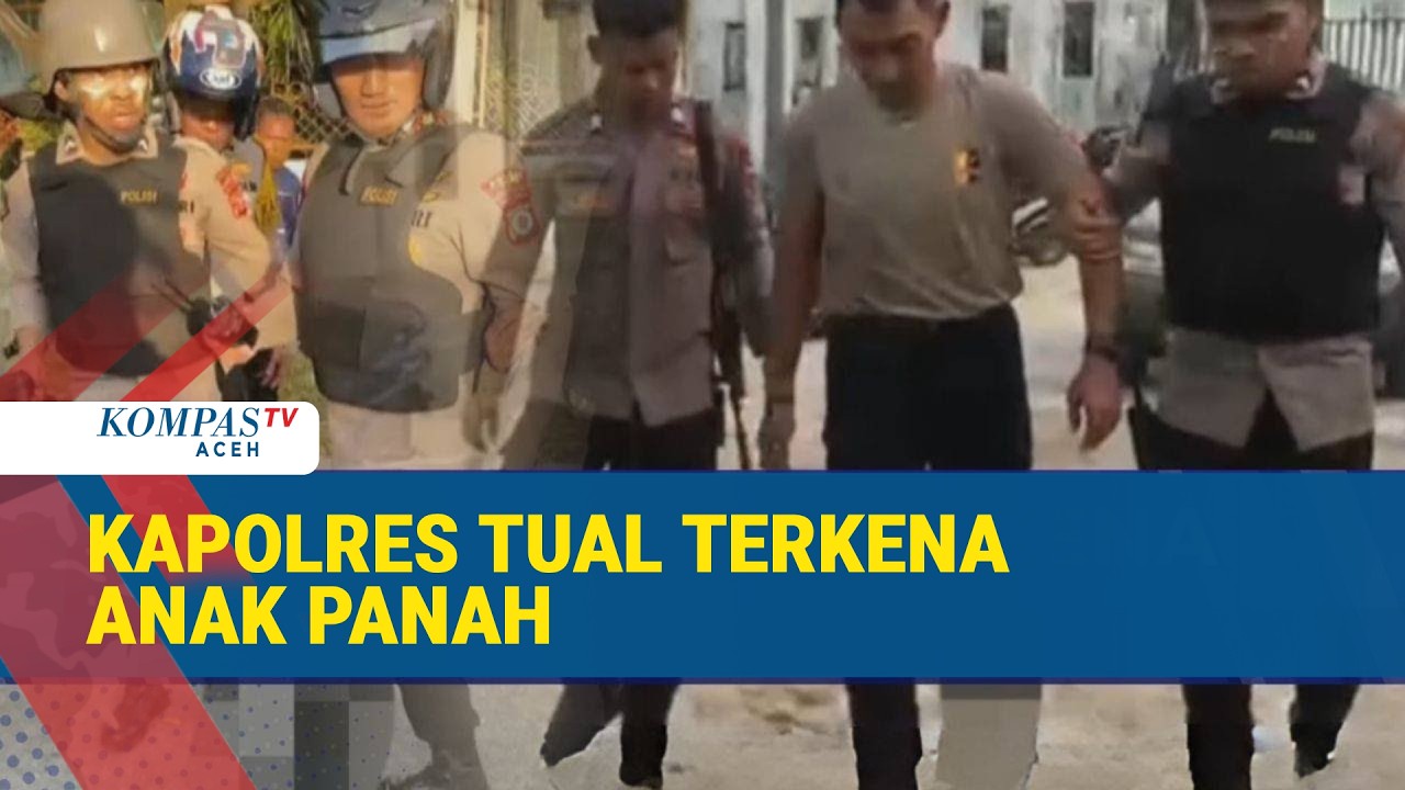 Kapolres Tual Alami Luka Panah di Kaki Kiri saat Amankan Kericuhan