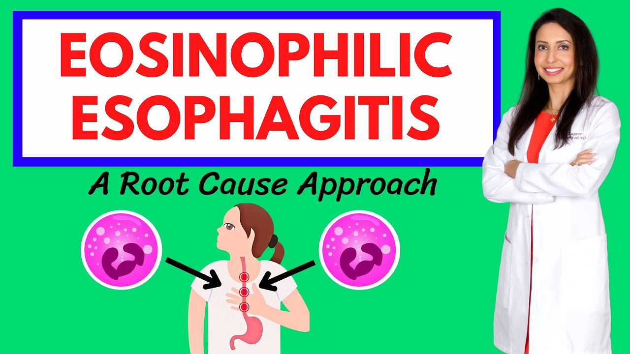 Эозинофильный эзофагит (ЭЭ): подход интегративной и функциональной медицины доктора Раджсри