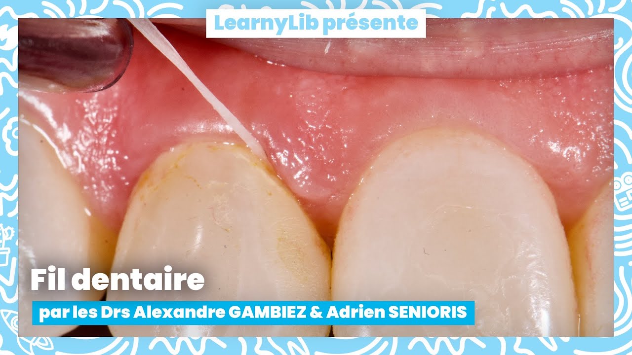 🦷 Motivation à l'hygiène : le fil dentaire avec les Drs GAMBIEZ & SENIORIS !
