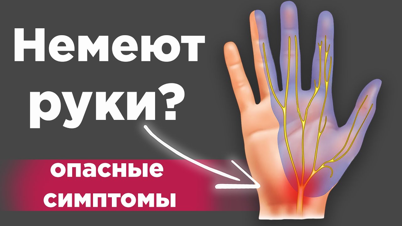 Немеют руки и пальцы? Срочно сделай ЭТО, пока не поздно!