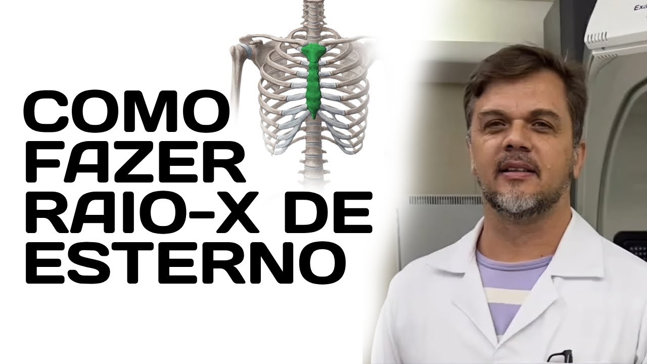 Raio-x do osso Esterno - Obliqua Anterior Direita /perfil