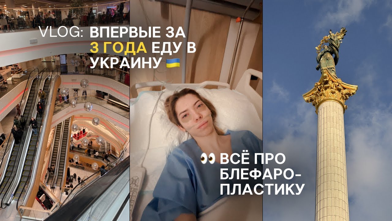 VLOG | еду в Украину впервые за три года: мои ощущения, первая операция в 18,  блефаропластика
