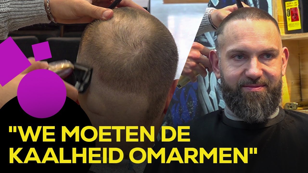Haartransplantaties steeds populairder