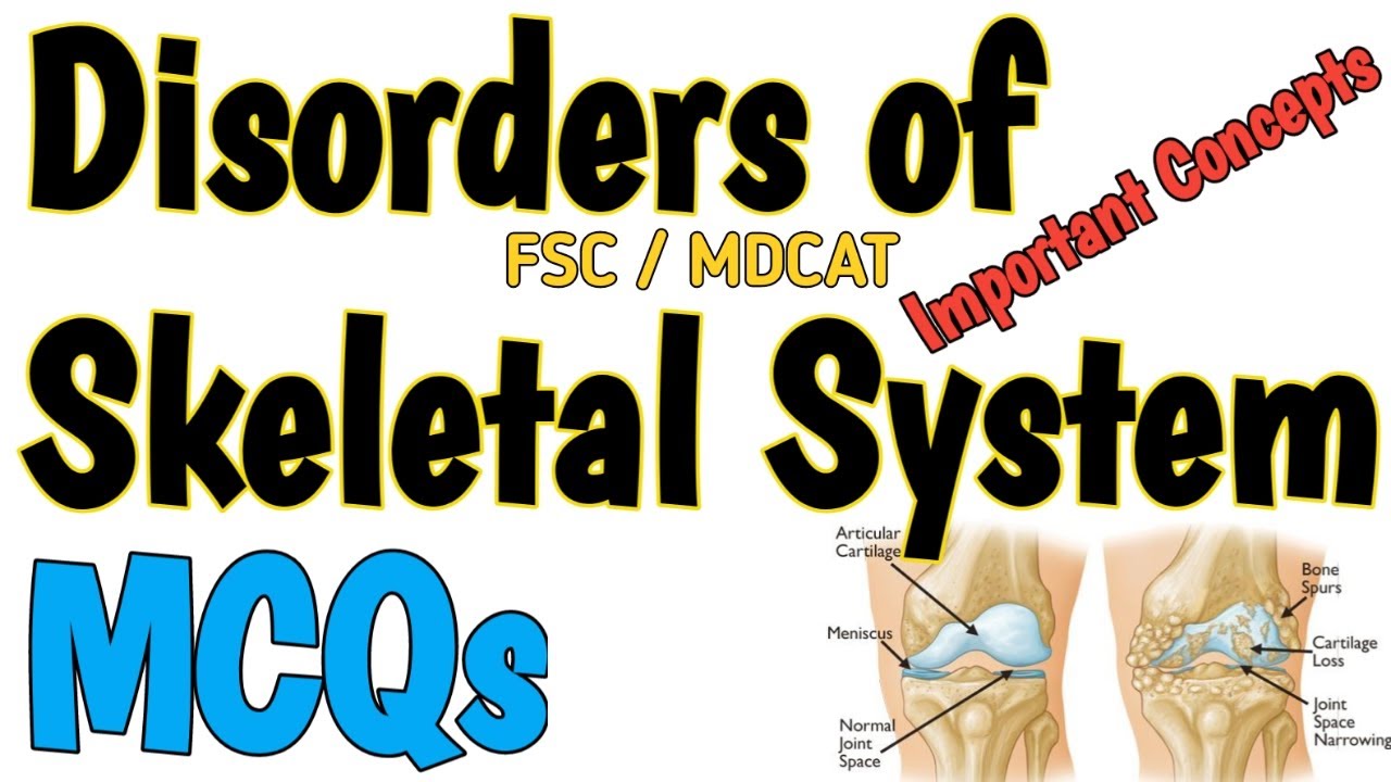 DISORDERS OF SKELETAL SYSTEM | MCQS | SUPPORT AND LOCOMOTION | FSC BIOLOGY and MDCAT | NEET