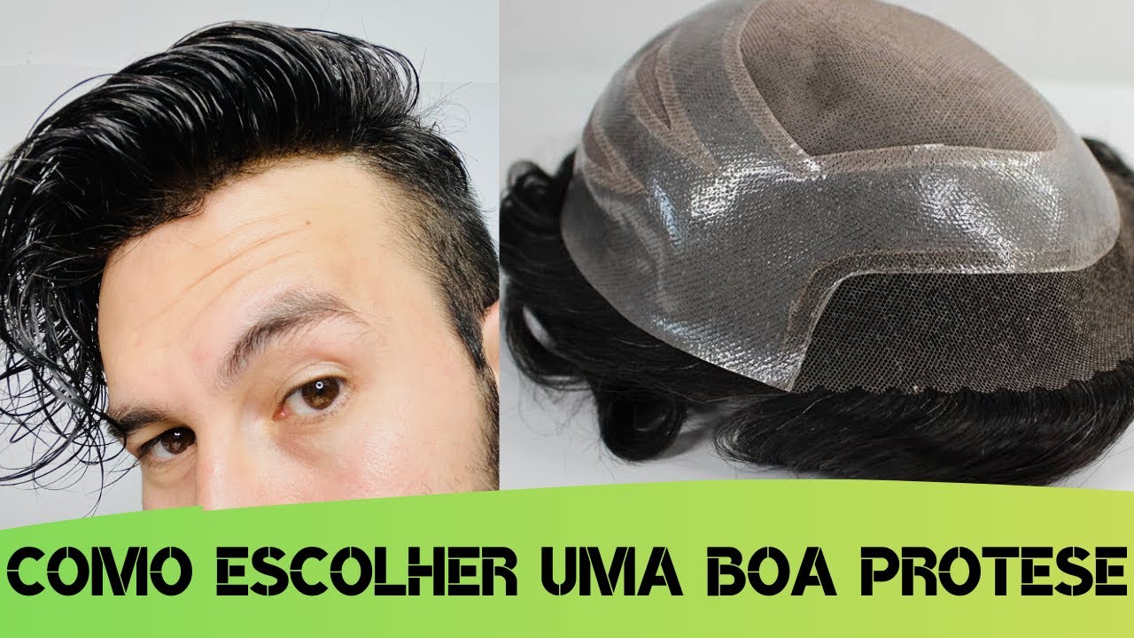 COMO COMPRAR UMA PROTESE NA INTERNET | COM SEGURANÇA #PRÓTESECAPILARMASCULINA | @JADSON.ANDRESEN