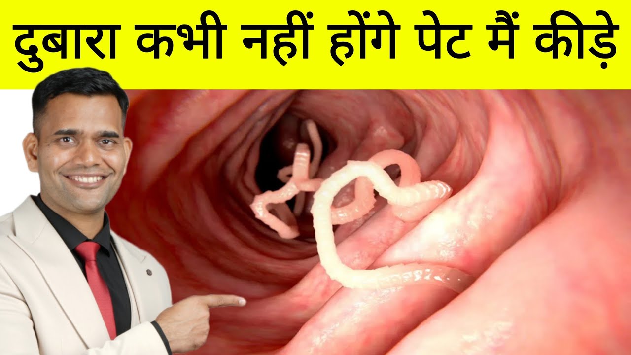 बस ये उपाय कर लो दुबारा कभी नहीं होंगे पेट मैं कीड़े | How To Treat Stomach Worms | Pin Worms