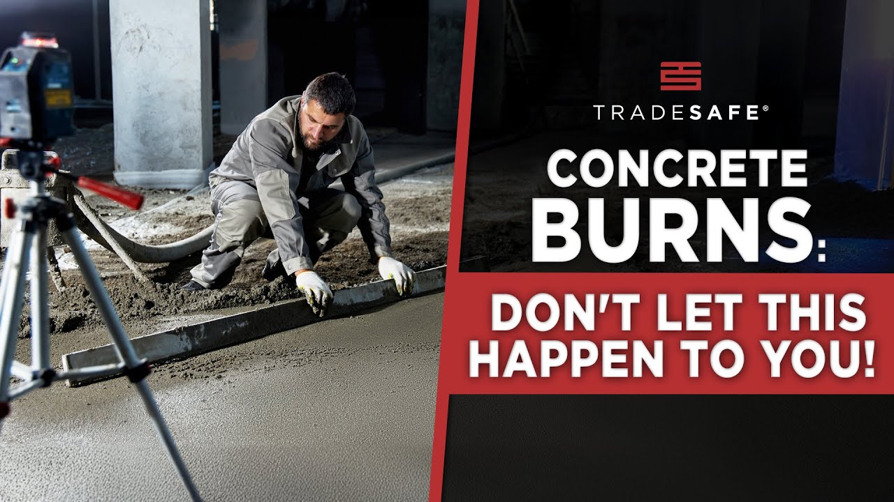 Concrete Burns: Why Does Concrete Burn & How to Treat It