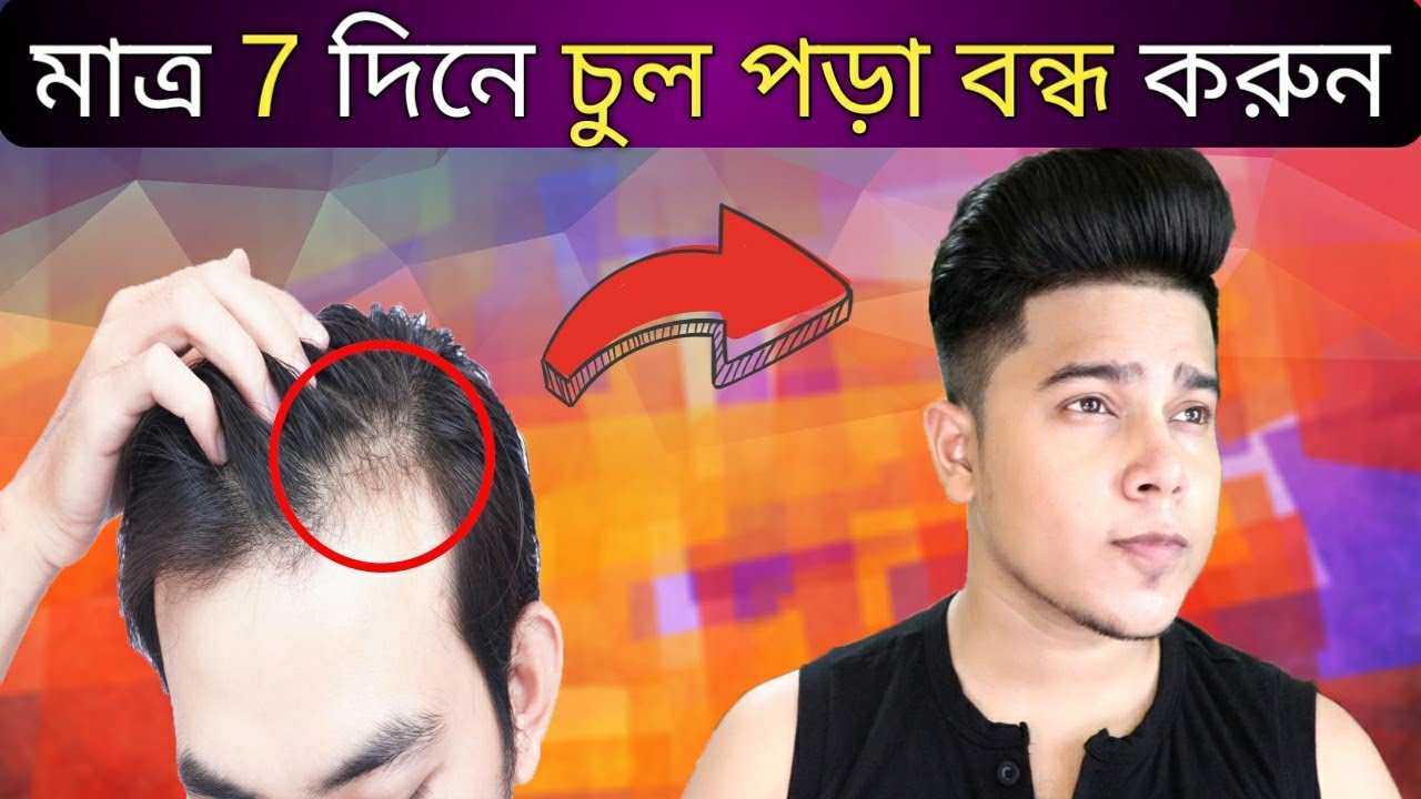 কম বয়সেই চুল পড়ে যাচ্ছে ? জেনেনিন Hair Fall বন্ধ করার 100 % কার্যকরী উপায়
