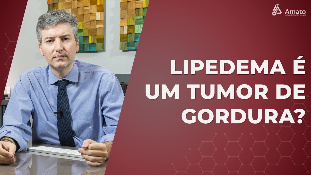 Lipedema é um Tumor de Gordura? Fakenews Saúde das suas pernas