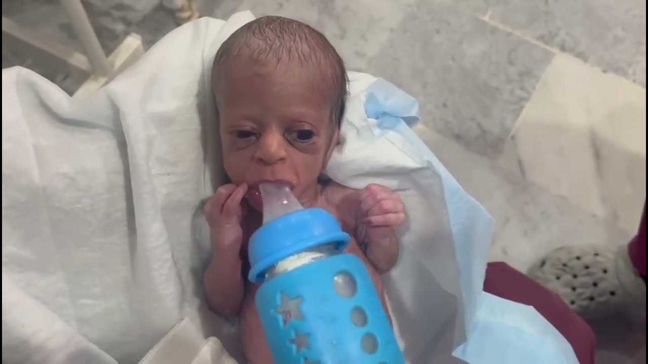 Premature Baby’s First Feeding 🍼 | Tiny Drops, Endless Hope