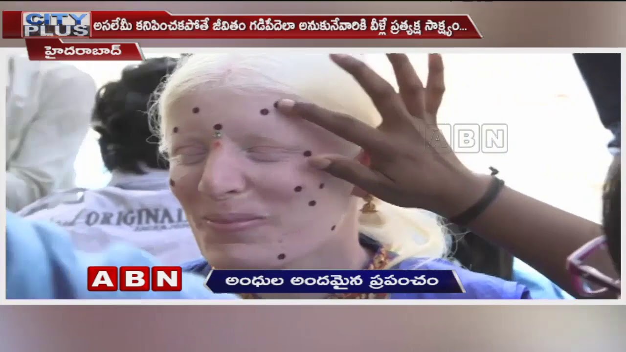 L V Prasad Eye Institute Rehabilitation Centre In Hyderabad | ABN Special Focus