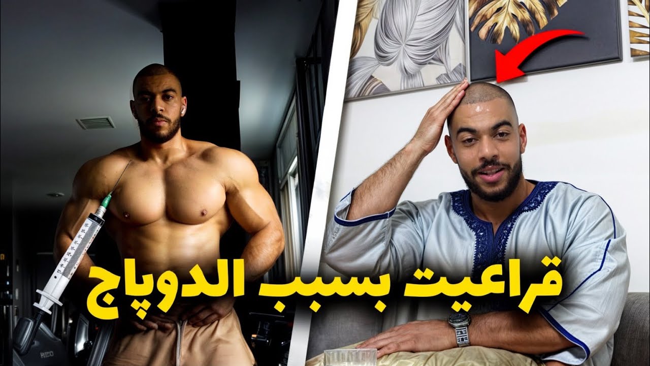 LEGEND SERIES - EP 6 - واش قراعيت بسبب الهرمونات 💉- حافظوا على الشعر ديالكم مديروش نفس الخطأ ⛔️