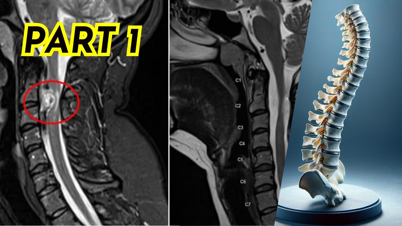 Back Fixes You've Never Seen Before: Weekend Spine Marathon (Part 1)