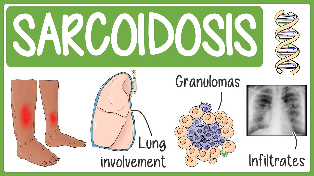 Sarcoidosis in 3 Minutes
