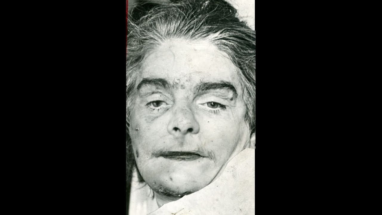 Unsolved Pillbox Mystery | Cold Case of The Wirral Peninsula