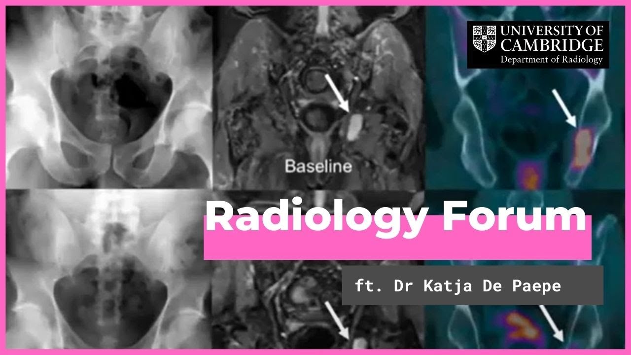 'The Role of Whole-Body MRI in Oncology' by Dr Katja De Paepe
