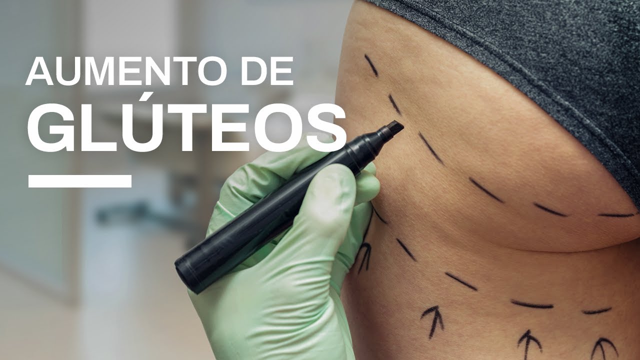 Aumento de glúteos mínimamente invasivo | Clínica Barrenechea
