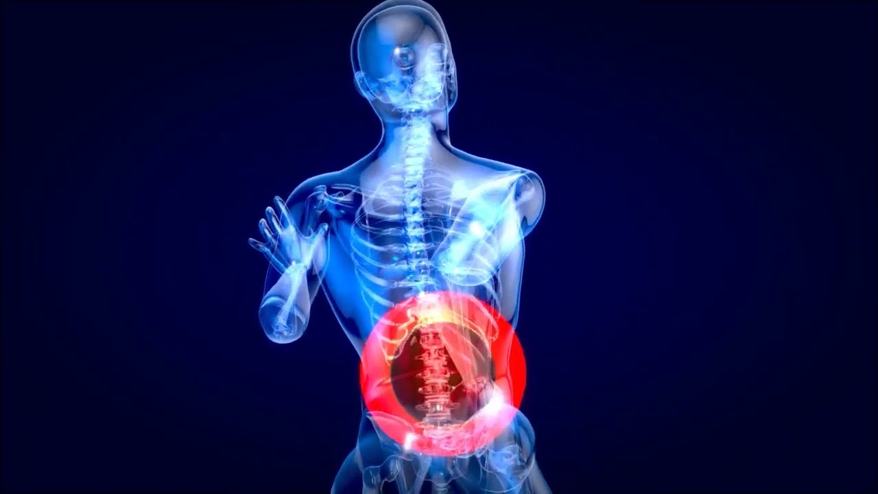 Solutions for Back Pain