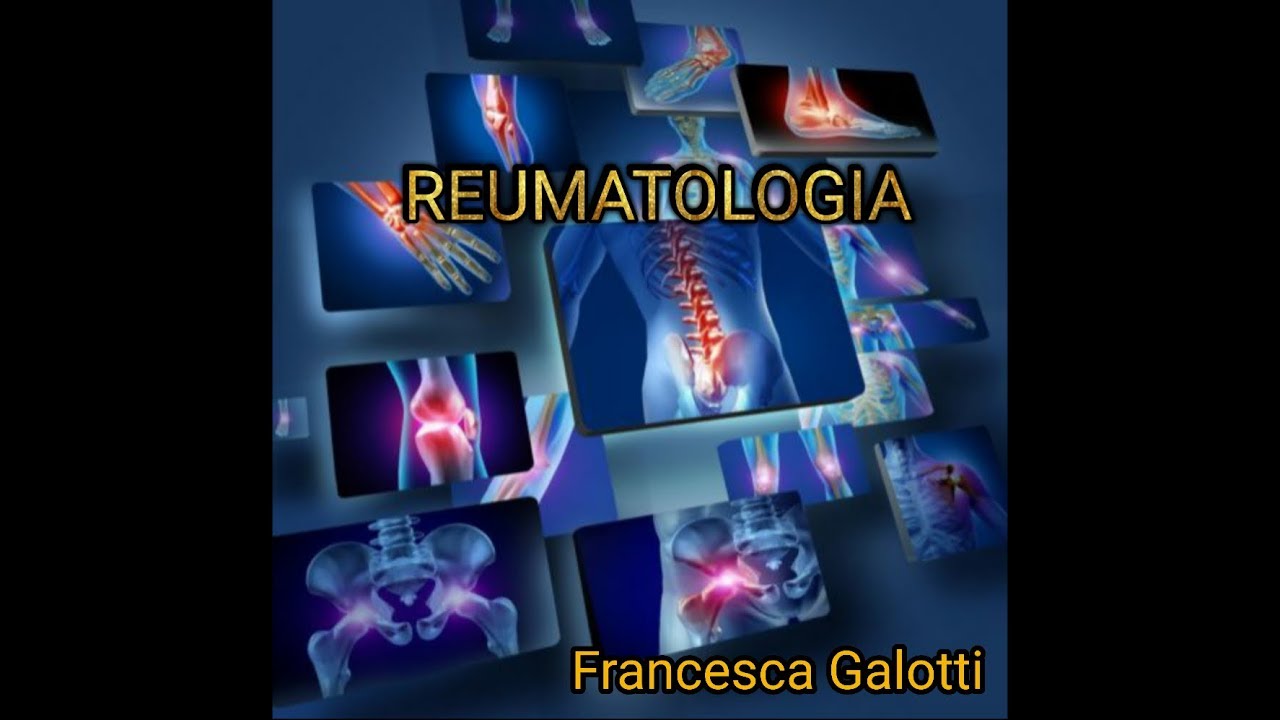 Reumatologia, Lezione 5, Lupus