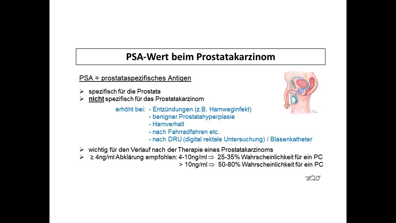 PSA-Wert beim Prostatakarzinom | Strahlentherapie Prof. Hilke Vorwerk