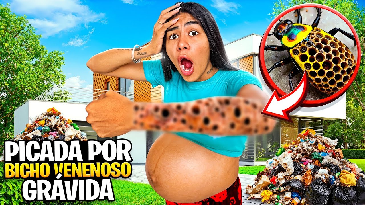 FUI PICADA POR UM BICHO VENENOSO GRÁVIDA *Fui pro hospital? 
