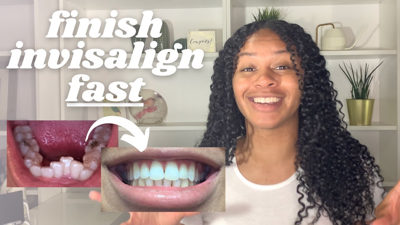 Как ускорить лечение Invisalign