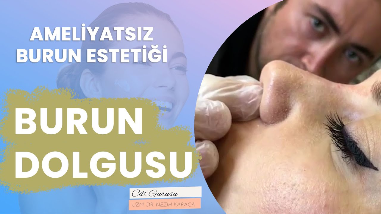 Burun Dolgusu Hakkında Herşey