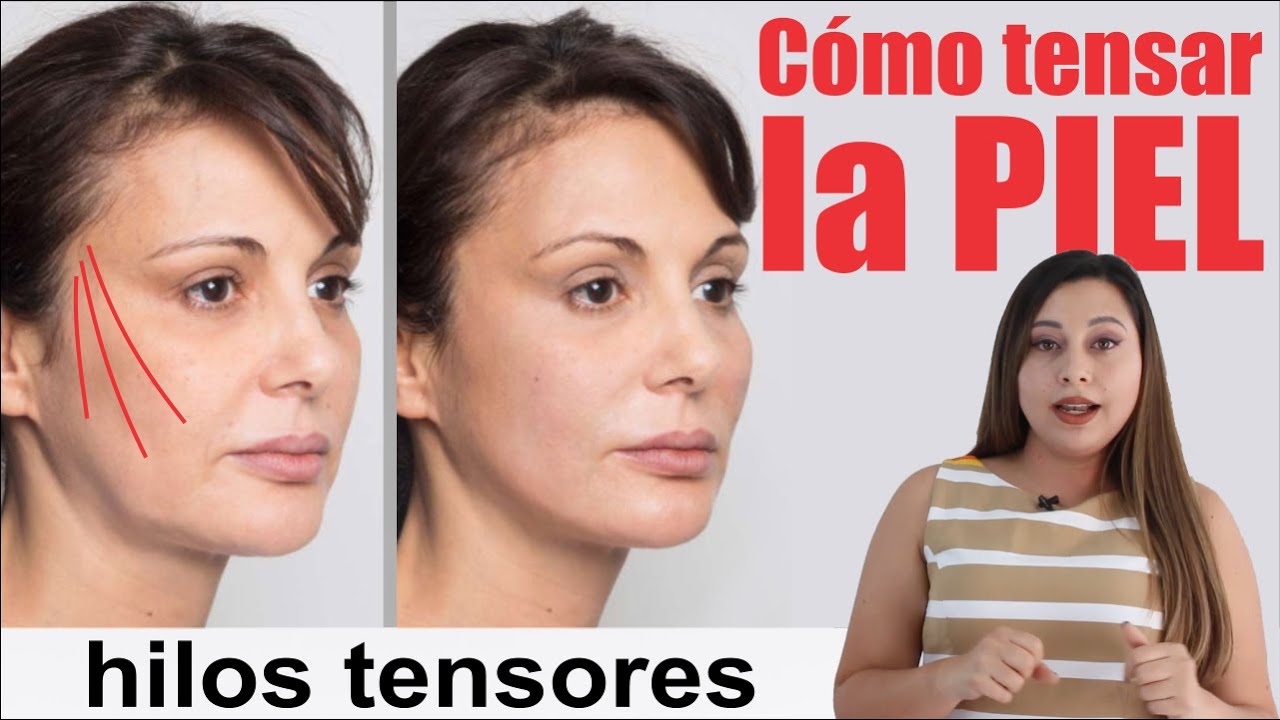 Rejuvenece con HILOS TENSORES 💄 pdo y pcl 👄 Tipos y Usos 💄 Lisos y espiculados 👄 ETERNA JUVENTUD