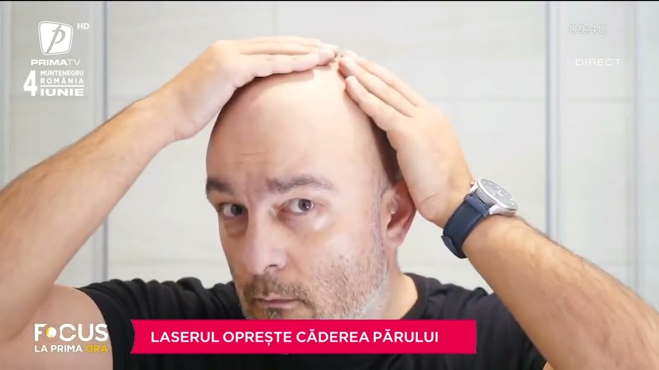 TRATAMENTUL CU LASER CARE OPREȘTE CĂDEREA PĂRULUI. SĂNĂTATE CU STIL CU LUCIANA INDRE ȘI ENSAR DUMAN