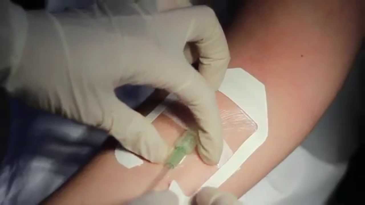 Pharmapore - Curativo Transparente Fenestrado para Acesso Periférico