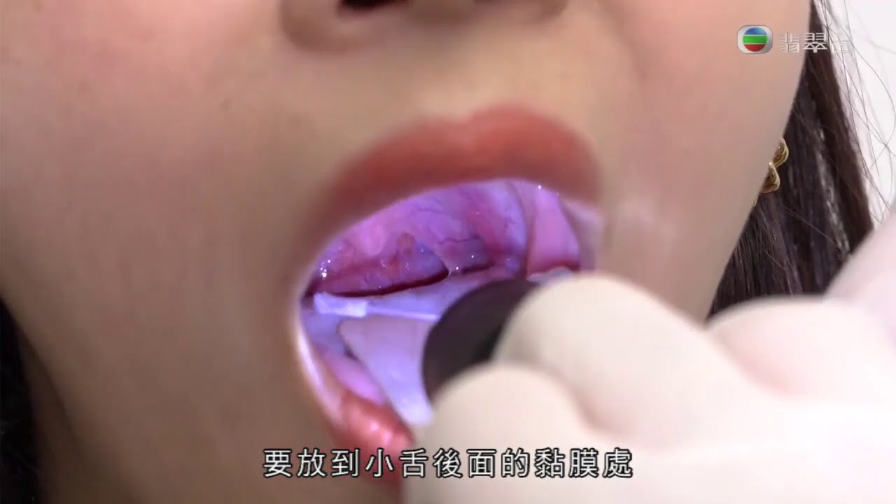 【東張西望】利穎怡無懼痛苦乾嘔示範全民檢測採樣方法