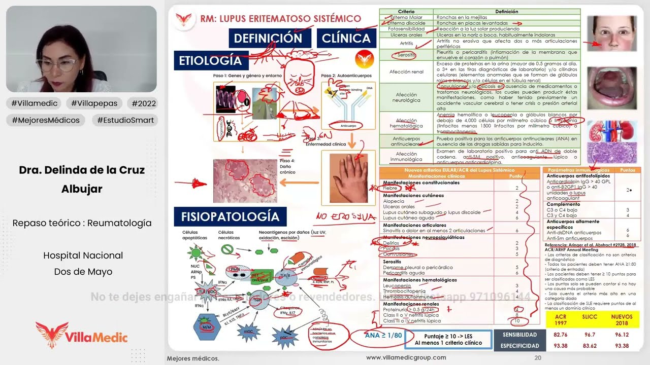 LUPUS ERITEMATOSO SIST&Eacute;MICO - REUMATOLOG&Iacute;A - VILLAMEDIC